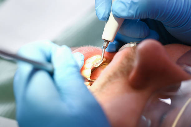 Best Emergency Treatment for Dental Infections or Abscesses in Dawson, TX